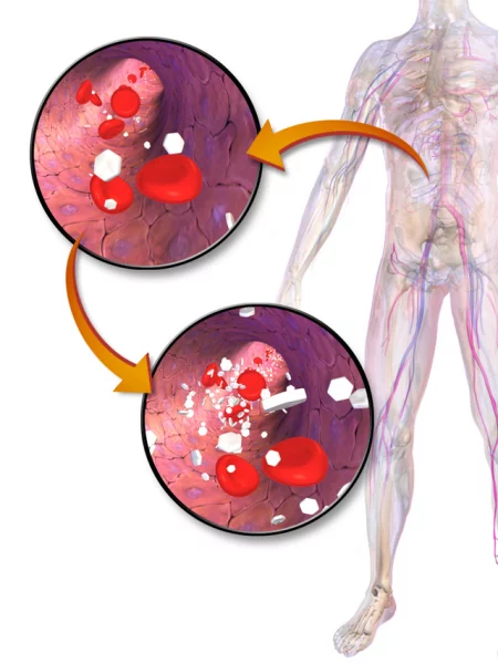 Excess sugar increases the risk of metabolic issues such as high blood pressure and high cholesterol