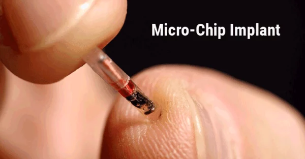 The process of implanting an NFC chip into the hand, showcasing the intersection of humans and technology