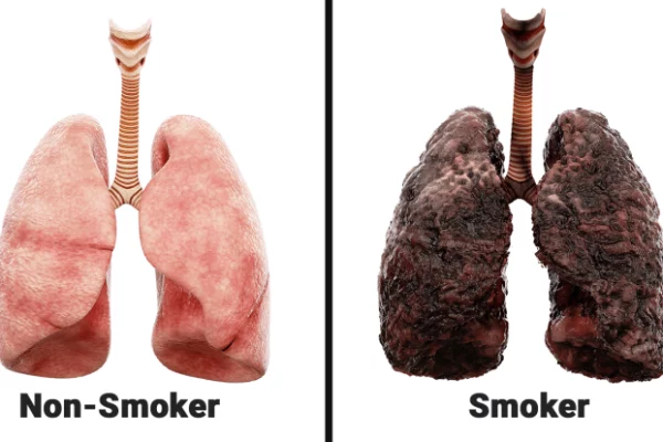 Healthy lungs compared to lungs damaged by smoking