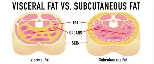 Reducing visceral fat is key to improving insulin sensitivity and lowering diabetes risk