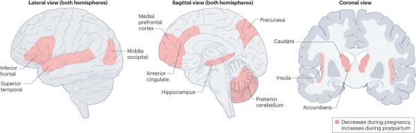 Studies indicate that the changes in the brain structure of pregnant women enhance their ability to recognize signals from their newborn, supporting caregiving and emotional bonding between mother and child